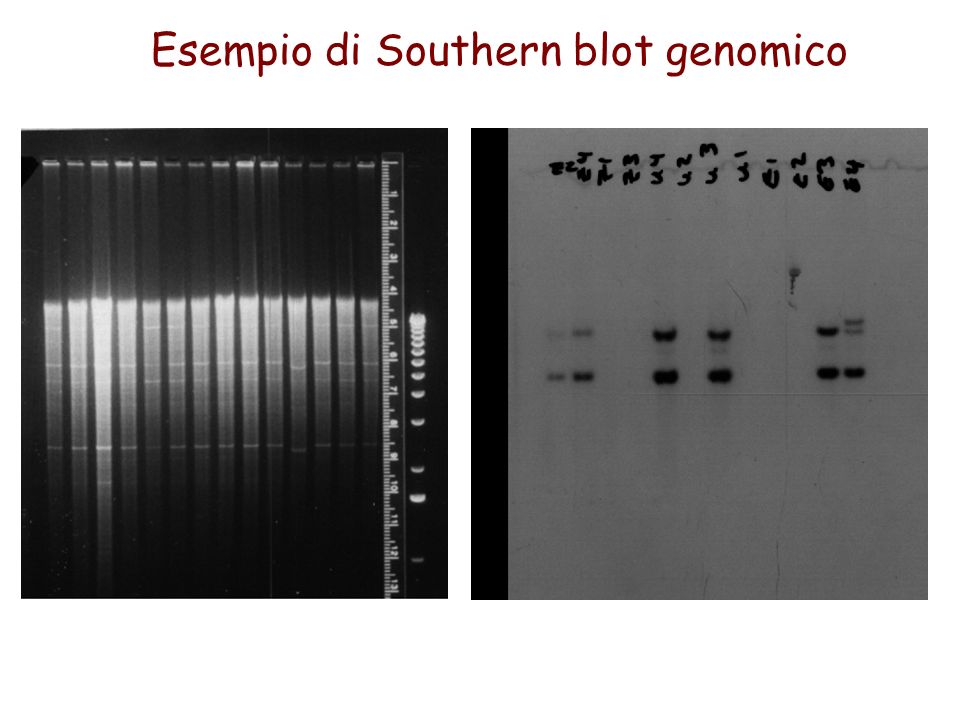 Esempio di Southern blot genomico