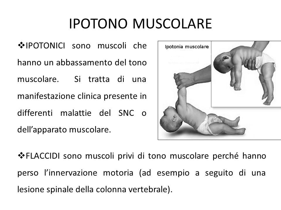  IPOTONICI sono muscoli che hanno un abbassamento del tono muscolare.